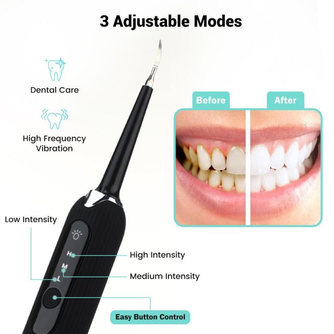 High Frequency Electric Ultrasonic Dental Tartar Plaque Calculus Tooth Remover Set Kits Cleaner with LED Screen – Black